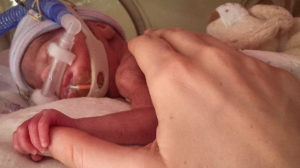 Premature babies require intensive care that can disrupt the emotional connection between mothers and their infants. Family Nurture Intervention in the NICU is designed to help families overcome those barriers to connection.