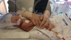 Premature birth puts children at increased risk for many challenges, including behavioral problems, learning difficulties, and autism spectrum disorders. Family Nurture Intervention in the NICU has been shown to decrease these risks.